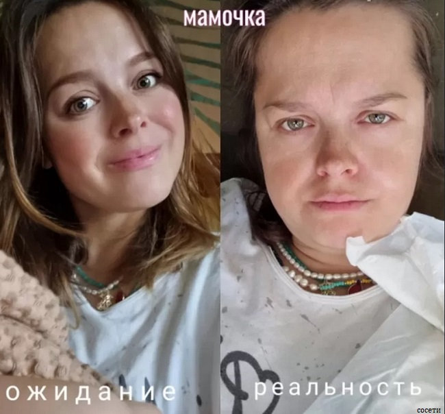 Наталь Медведева до и после родов 