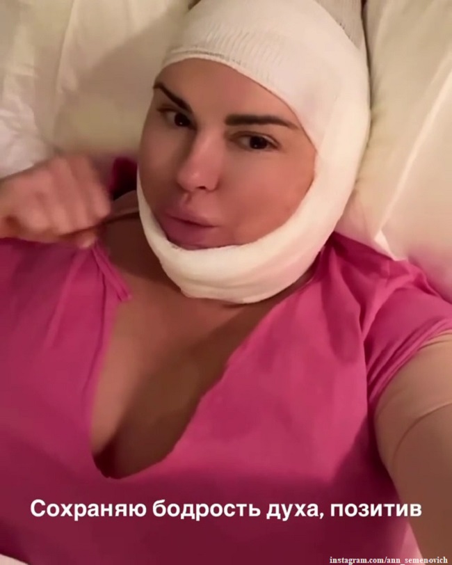Анна Семенович после операции