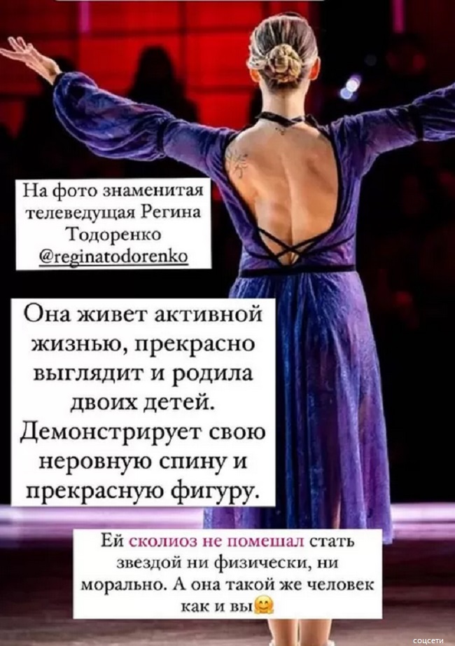 Регина Тодоренко показала изуродованную спину 