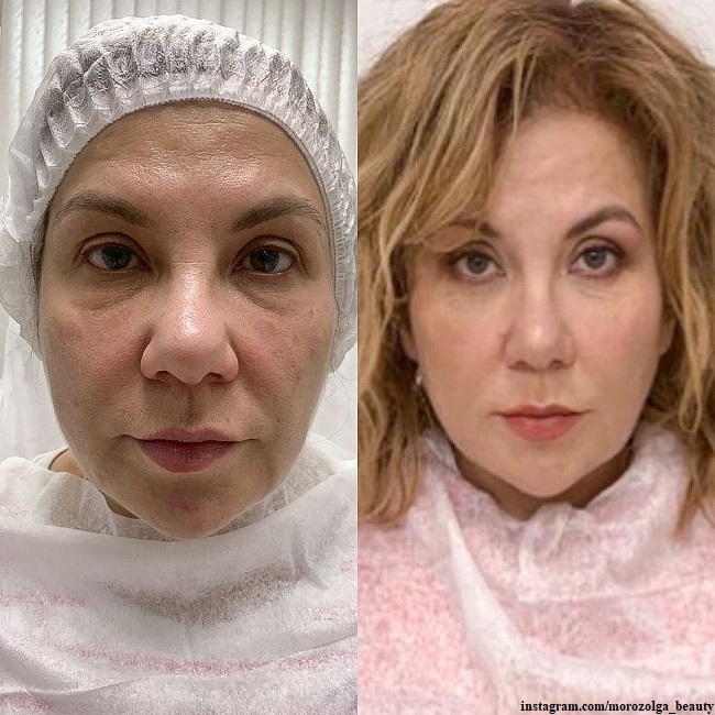 Марина Федункив до и после преображения