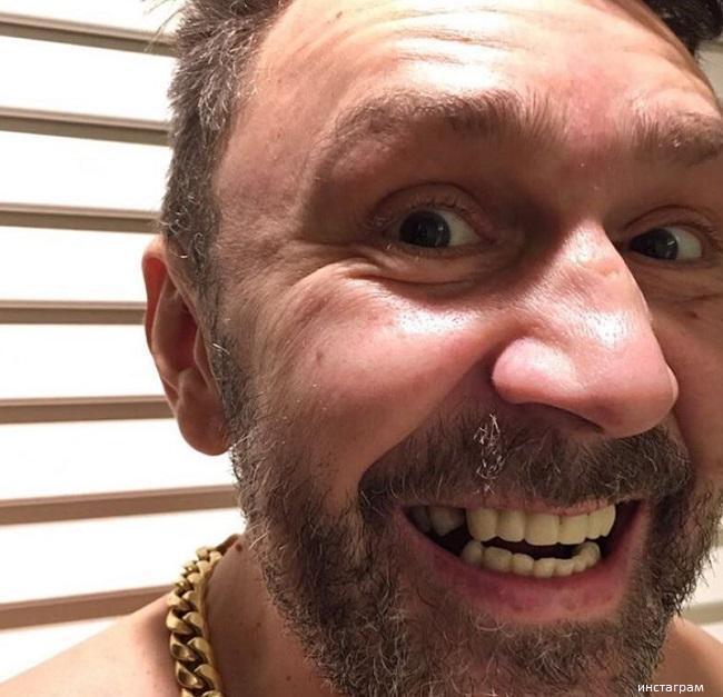 Сергей Шнуров сделал себе новые зубы 