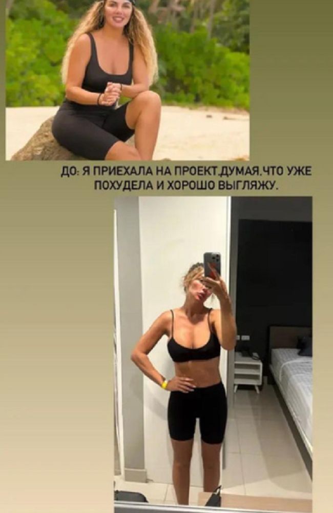 Анна Седокова до и после 